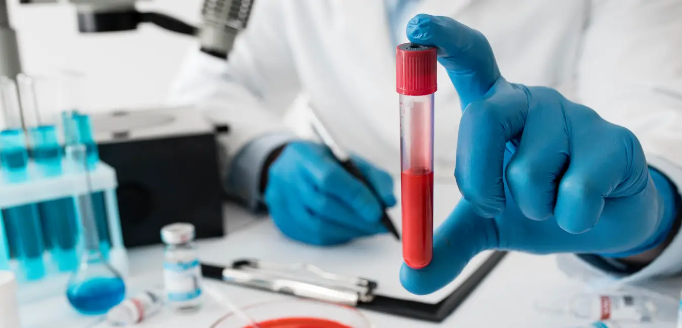 Blood Test
